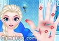 冰雪奇緣艾莎手凍傷